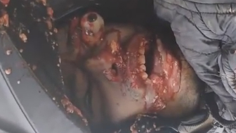 Motorcyclist Killed By Garbage Truck In Colombia