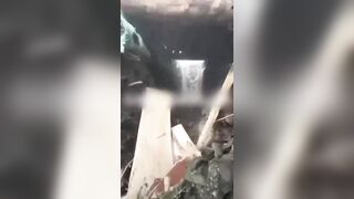 The hand is just useless shit