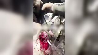 The hand is just useless shit