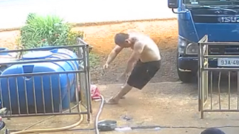 Man Gets Electrocuted By Live Cable, Lucky To Be Alive