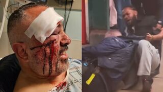 MTA operator  attacked by rider who spat at him in  the Bronx