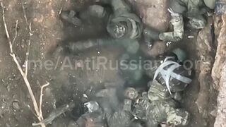 The Russian eye popped out of its socket