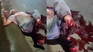 Driver Swerves to Avoid Massive Pothole, Strikes Elderly Cyclist
