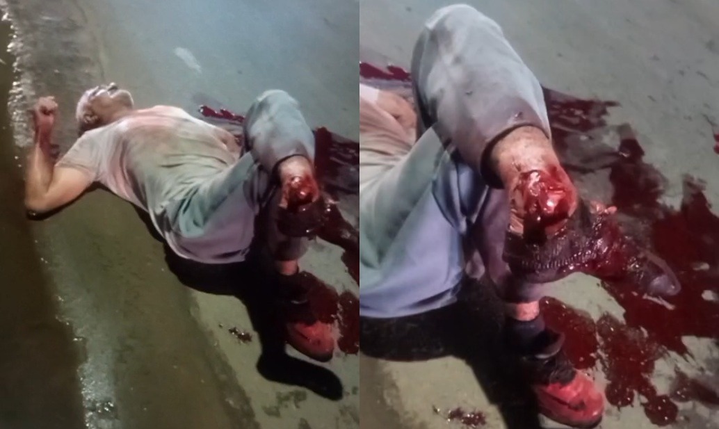 Driver Swerves to Avoid Massive Pothole, Strikes Elderly Cyclist