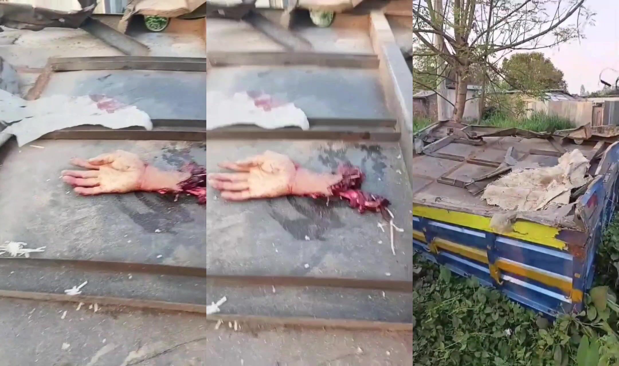 Hand severed in traffic accident