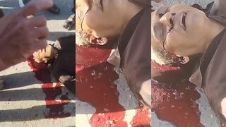 Blood pours from ears after hit by car