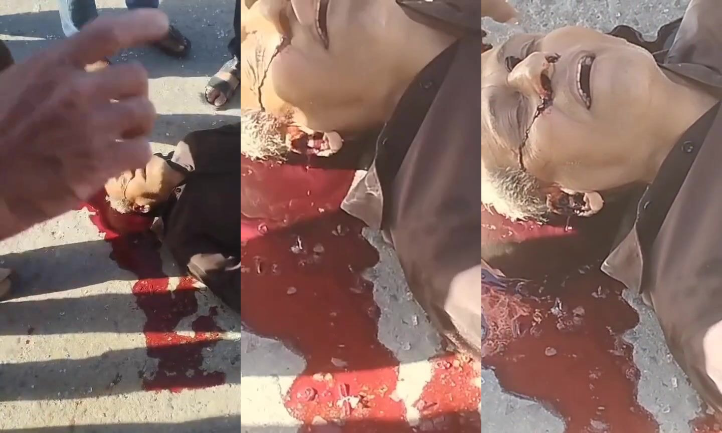 Blood pours from ears after hit by car