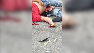 Aftermath Of Collision Between Two Motorcycles In Venezuela