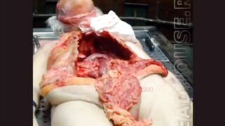 Autopsy Photos
