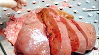 Autopsy Photos
