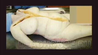 Autopsy Photos