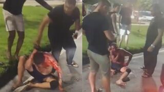 Cellphone Thief Bleeding After Being  Kicked By Locals