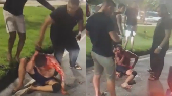 Cellphone Thief Bleeding After Being  Kicked By Locals