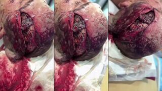 A terrible head wound to a Russian soldier