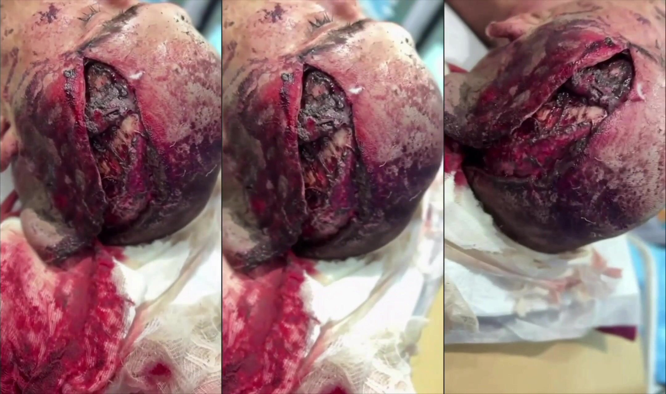 A terrible head wound to a Russian soldier