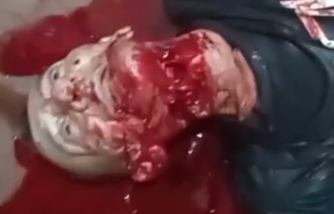 Gruesome Family Murder: Sickle Used to Slit Brother's Throat in Brazil