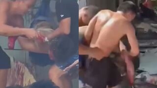 Gas Explosion Survivor Rescued With Limbs Missing