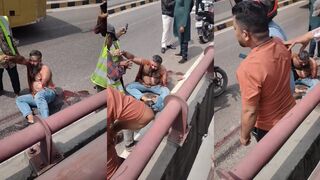 Arm ripped off riding moto