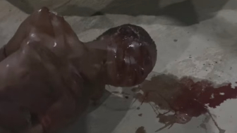 Adandoned By Gang Mates Thug Vomits Blood After Taking Good Beating