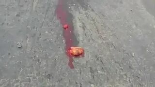 Classic:Girls heart ejected during accident and still beating