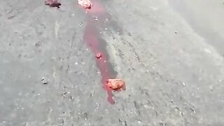 Classic:Girls heart ejected during accident and still beating