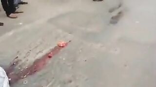 Classic:Girls heart ejected during accident and still beating