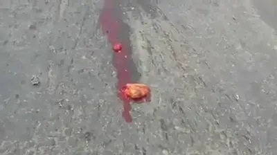 Classic:Girls heart ejected during accident and still beating