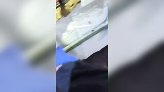 Shocking: RPG-7 ammunition penetrates the body of a UA soldier