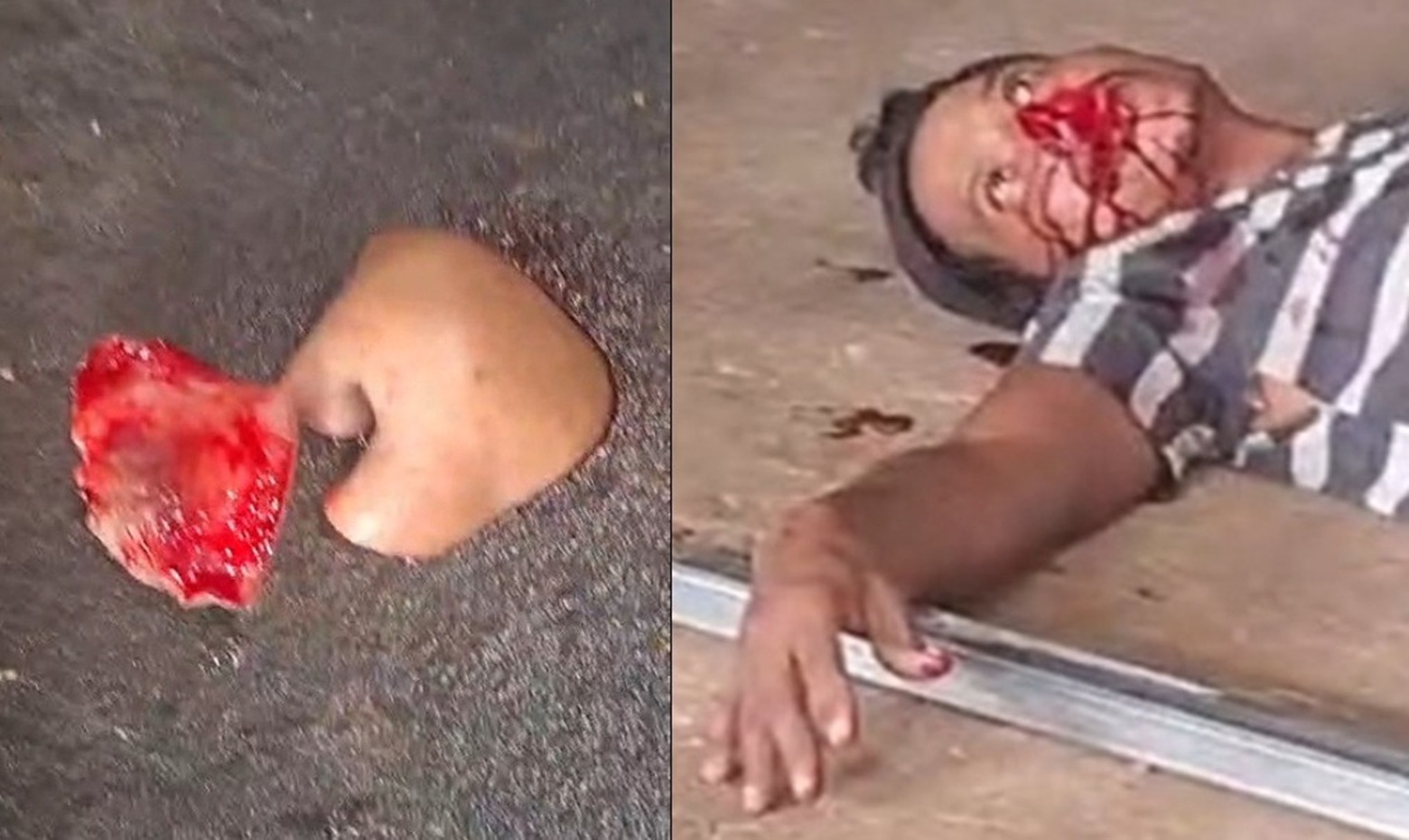 Worker Loses Part of Face and Arm in Gas Cylinder Explosion While Cutting It in Half