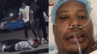 Doctor Brutally Attacked By Two Brothers After Dispute In Zimbabwe