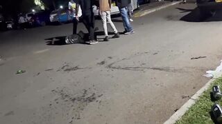 Doctor Brutally Attacked By Two Brothers After Dispute In Zimbabwe