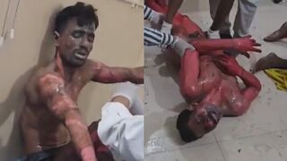 Victims Of Boiler Explosion At A Power Plant In India