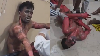 Victims Of Boiler Explosion At A Power Plant In India