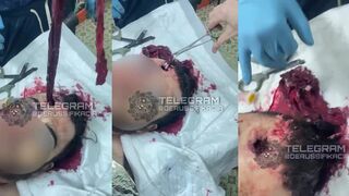 Russian first aid on the battlefield, the medic is fucking gobsmacked