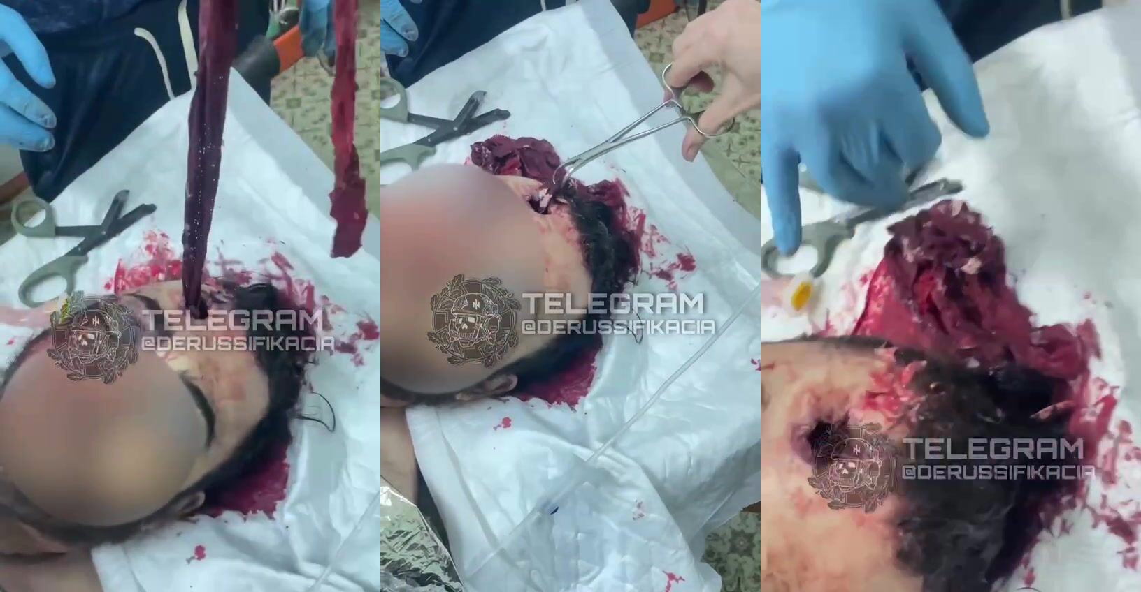 Russian first aid on the battlefield, the medic is fucking gobsmacked