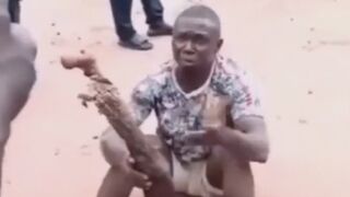 Mortician Caught Using Human Leg As Walking Stick