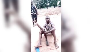 Mortician Caught Using Human Leg As Walking Stick