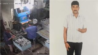 Private Factory Worker Loses Palm