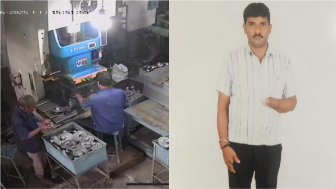 Private Factory Worker Loses Palm