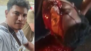 Blood Gushing Like a Crimson Waterfall from His Mouth and Nose