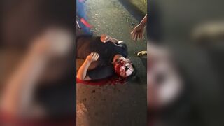 Blood Gushing Like a Crimson Waterfall from His Mouth and Nose