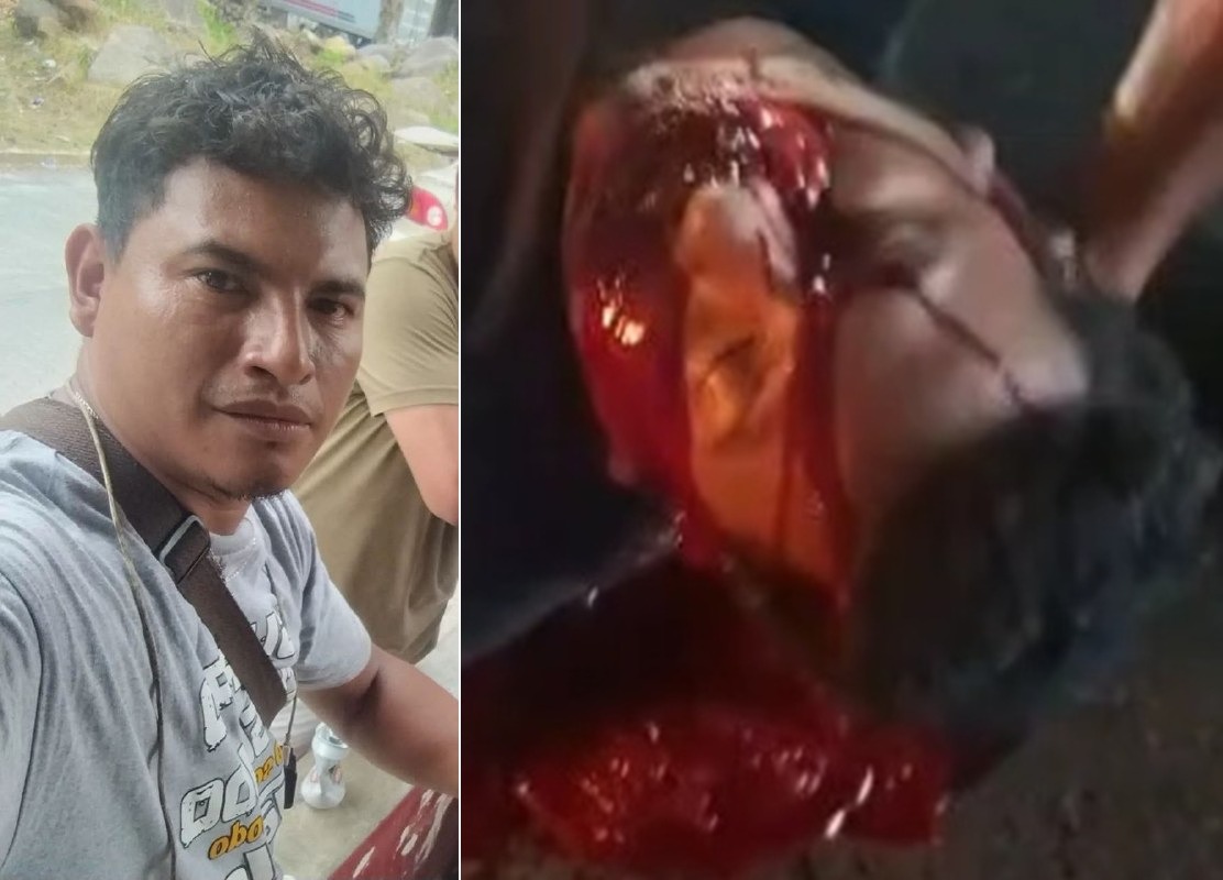 Blood Gushing Like a Crimson Waterfall from His Mouth and Nose
