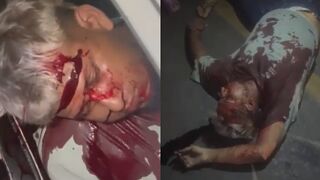 Seconds After Fatal Gang-Related Shooting On A Busy Street In Ecuador