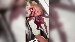 Seconds After Fatal Gang-Related Shooting On A Busy Street In Ecuador