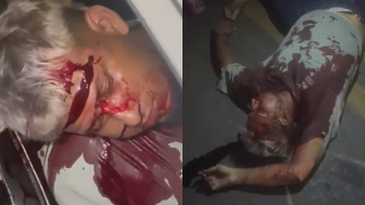Seconds After Fatal Gang-Related Shooting On A Busy Street In Ecuador