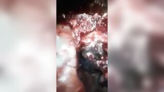 Brain removed by hands in Brazil