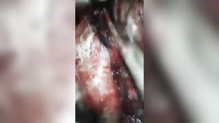 Brain removed by hands in Brazil