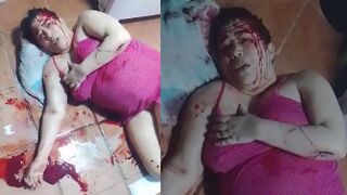 Shocked Woman Bleeding After Being Stabbed By Her Son-In-Law