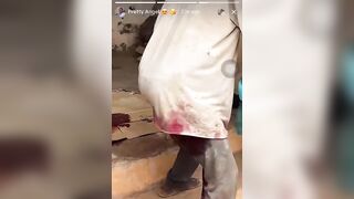 42-Year-Old Cocoa Farmer Slashes Off Manhood in Attempted Suicide at Aworowa