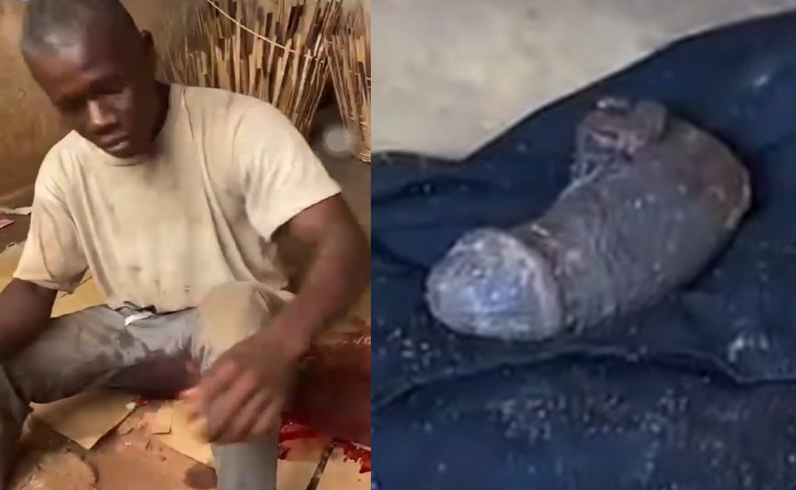 42-Year-Old Cocoa Farmer Slashes Off Manhood in Attempted Suicide at Aworowa